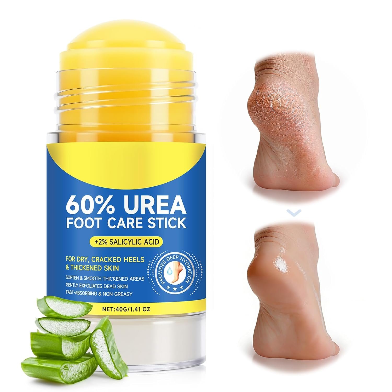 60% Urea Cream Stick with 2% Salicylic Acid, Maximum Strength Foot Cream Stick for Dry Cracked Heels & Calluses, Rapidly Softens Thick Skin – Non-Greasy & Fast Acting – 2-Day Visible Results